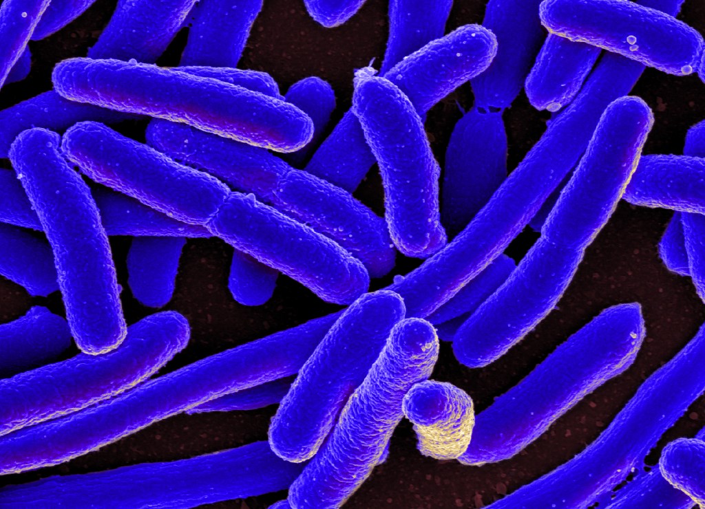 Scanning electron micrograph of E.coli bacteria